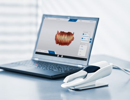 Digitaler Zahnabdruck